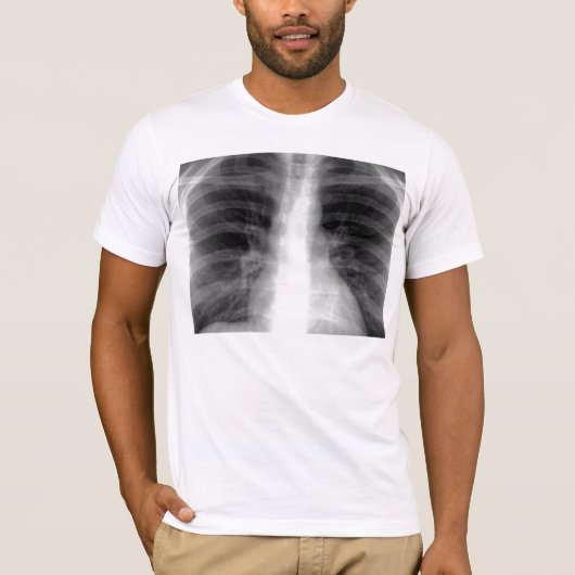 T-shirt Radiographie de la poitrine (Devant)