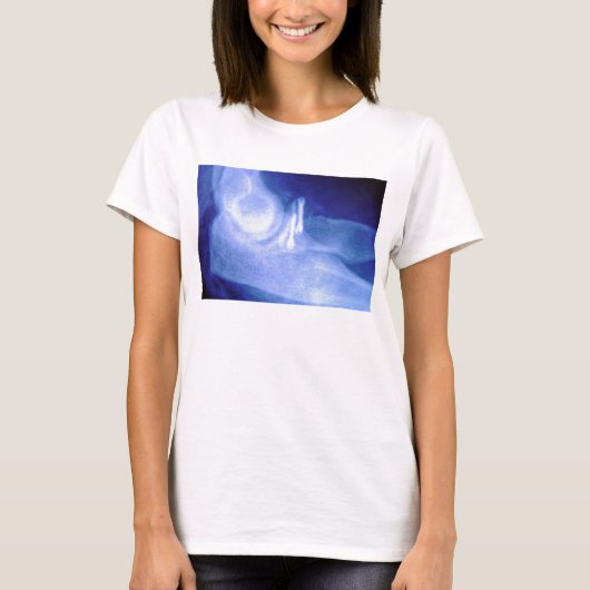 T-shirt Rayon X de coude avec des vis (Devant)
