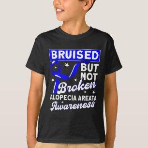 T-shirt Support Bruyé, Mais Pas Fractionné Alopecia Sensib