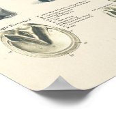 Tableau de l'anatomie de la jambe de cheval (Coin)