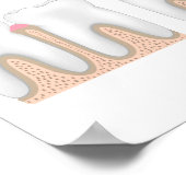 Tandaandoening Periodontale Poster (Hoek)