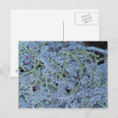 Tandheelkundige scanner, gekleurd briefkaart (Voorkant / Achterkant)