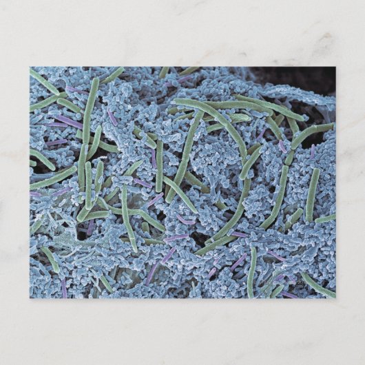 Tandheelkundige scanner, gekleurd briefkaart (Voorkant)