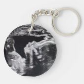 Tante To Be | Geboorteaankondiging | Echografie Sleutelhanger (Achterkant)