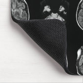 Tapis De Souris Analyse IRM du cerveau (Coin)