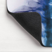 Tapis De Souris Art cervical de rayon X de Digitals (Coin)