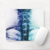 Tapis De Souris Art cervical de rayon X de Digitals (Avec souris)