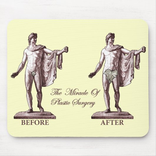 Tapis De Souris Avant et après (Devant)