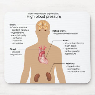 Tapis De Souris Complications principales de diagramme