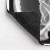 Tapis De Souris Coquillage de capot de rayon X (Coin)