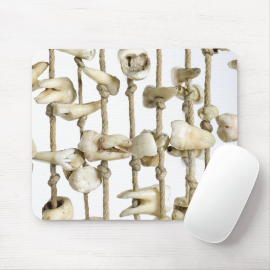 Tapis De Souris Funny Dental Photography Extracted Teeth Dentist (Avec souris)