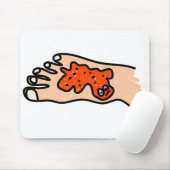 Tapis De Souris La maladie de pied (Avec souris)