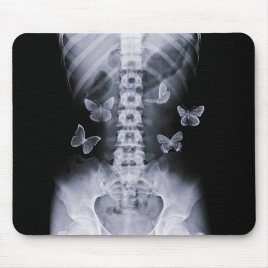 Tapis De Souris Papillons conceptuels Mousepad de rayon X (Devant)