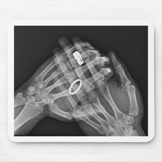 Tapis De Souris Participation de main (Devant)