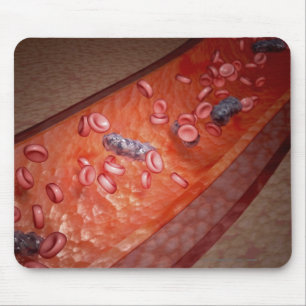 Tapis De Souris Rendu microscopique d'une infection de sang