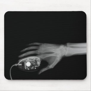 Tapis De Souris Souris à main et à ordinateur X-Ray