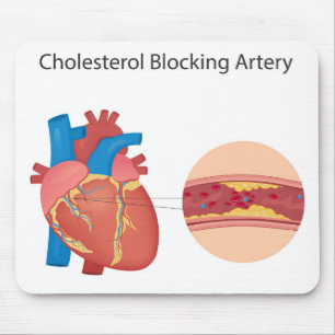 Tapis De Souris Vaisseaux sanguins étroits