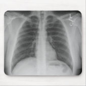 Tapis De Souris X-Ray Mousepad (Devant)