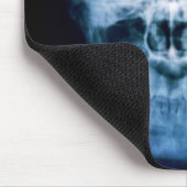 Tapis De Souris X-Tête (Coin)