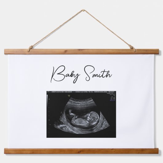 Tapisserie Suspendue Sonogramme de bébé personnalisé Ultrasons Bois hac (Devant)