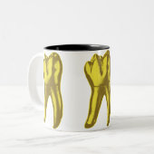 Tasse 2 Couleurs Dent en or (Devant gauche)