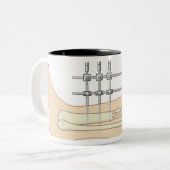 Tasse 2 Couleurs Fixator externe (Devant gauche)