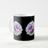 Tasse de café - éosinophilie (Devant gauche)