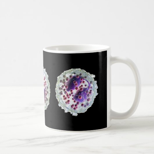 Tasse de café - éosinophilie (Droite)