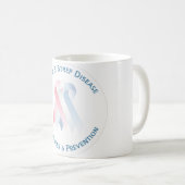 Tasse de conscience de GBS (Devant droit)
