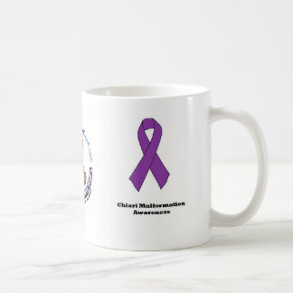 Tasse de conscience de malformation de Chiari
