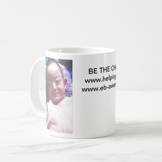 Tasse de Huy (Devant gauche)