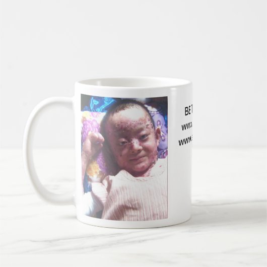 Tasse de Huy (Gauche)