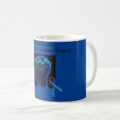 Tasse de survivant de DBS (Devant droit)