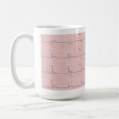 Tasse d'ECG (Gauche)