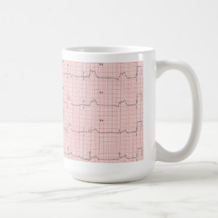 Tasse d'ECG