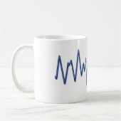 Tasse d'ER ECG (Gauche)