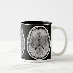 Tasse d'image de cerveau d'IRM