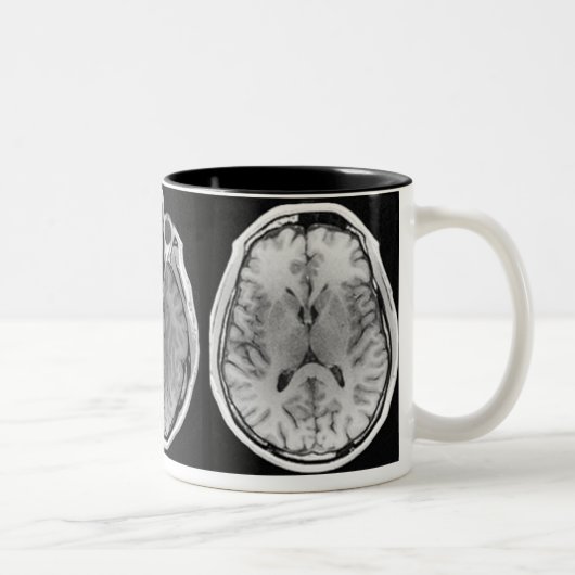 Tasse d'image de cerveau d'IRM (Droit)