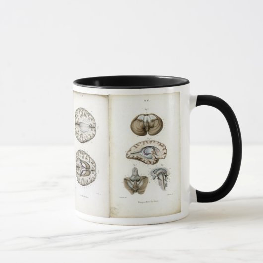 Tasse d'impression d'anatomie de cerveau (Droite)