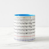 Tasse du sommeil EEG - sommeil de l'étape 2 (Centre)