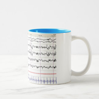 Tasse du sommeil EEG - sommeil de l'étape 2