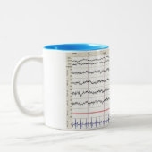 Tasse du sommeil EEG - sommeil de l'étape 2 (Gauche)