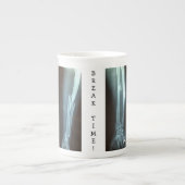 Tasse En Porcelaine Rayon cassé et Ulna Xray "Temps de pause" (Devant)