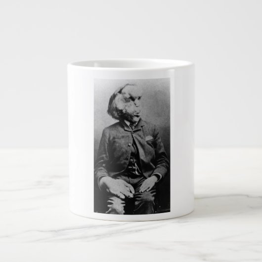 Tasse Géante Joseph "John" Merrick L'Homme Eléphant de 1889 (Devant)