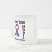 Tasse Givré La recommandation importe fibrose pulmonaire (Devant gauche)