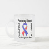 Tasse Givré La recommandation importe fibrose pulmonaire (Gauche)