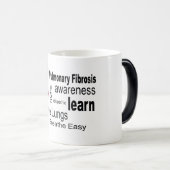 Tasse idiopathique de conscience de fibrose (Devant droit)