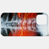 Telefoontas voor X-Ray Digital Artwork Case-Mate iPhone Case (Achterkant (horizontaal))