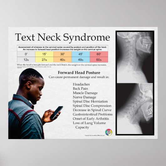 Text Neck Pain Syndrome Chart Poster (Voorkant)