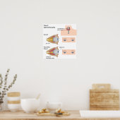 Thyroïd eye disease Poster (Keuken)